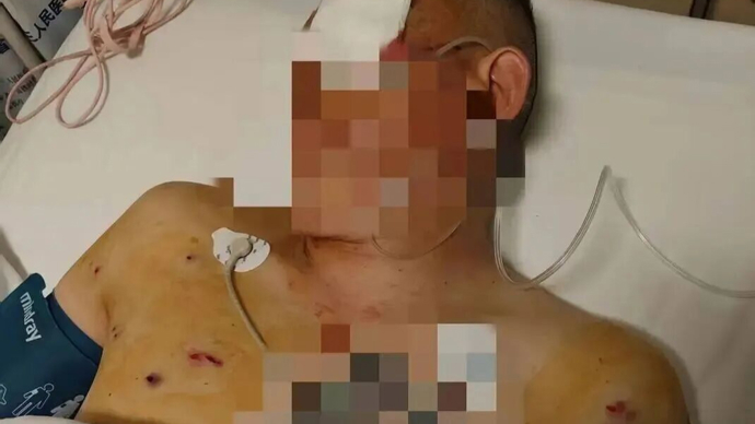 中国农业银行中牟县支行回应客户遭抢事件_男子取款170万银行门口遭抢致重伤 银行保安未帮忙应担责_取170万遭抢当事人:歹徒照头就一枪