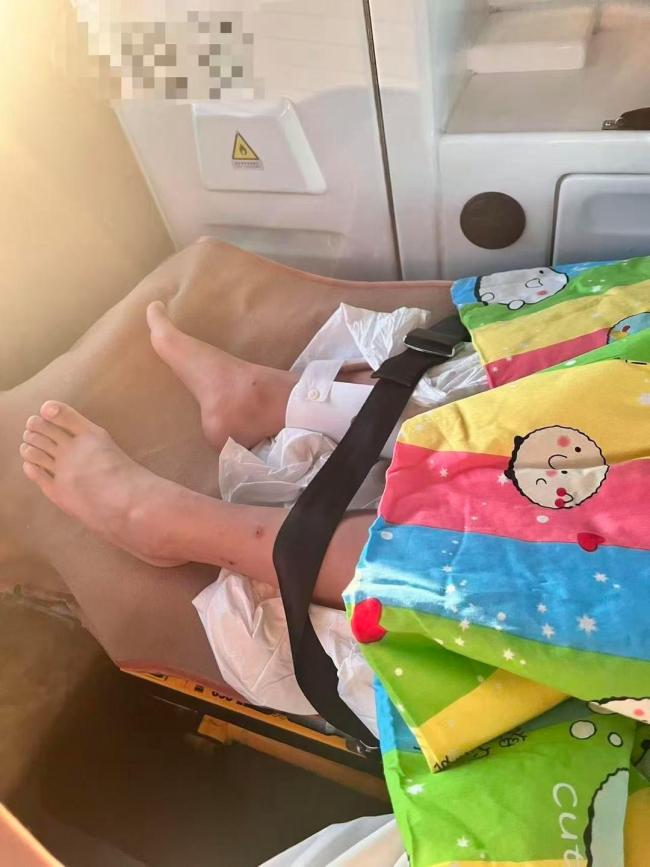 孩子火车上被男乘客砸骨折，对方术后失联，朱女士无奈求助