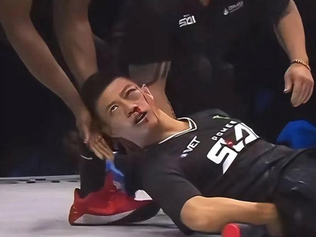 赵鸿刚公布病历：看东西重影需手术