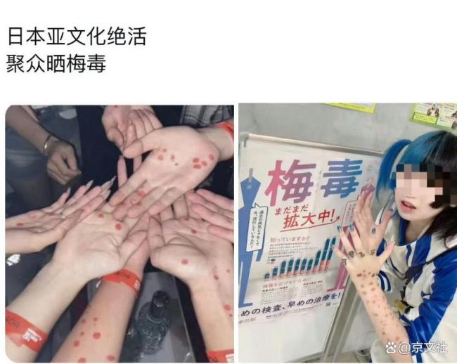 日本年轻人聚众晒梅毒 亚文化背后的隐患